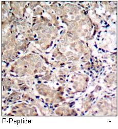 FKHR (Phospho-Ser319) Antibody
