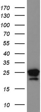 FKLF / KLF11 (KLF11) antibody