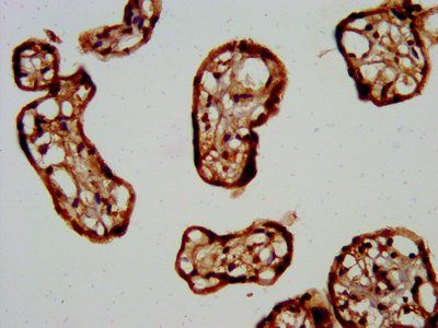 FKRP Antibody
