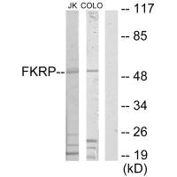FKRP antibody