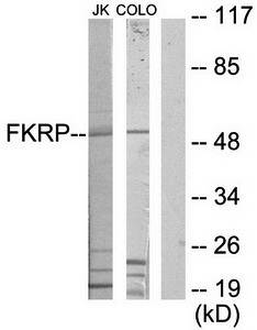 FKRP Antibody