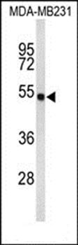 FLAD1 Antibody (C-term)