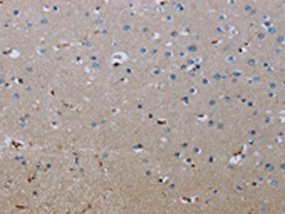 FLCN Antibody