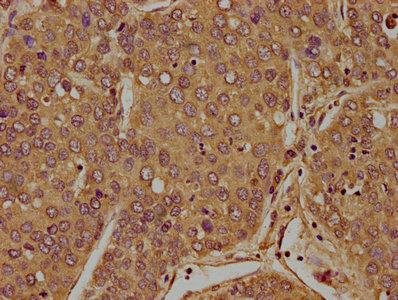 FLCN Antibody