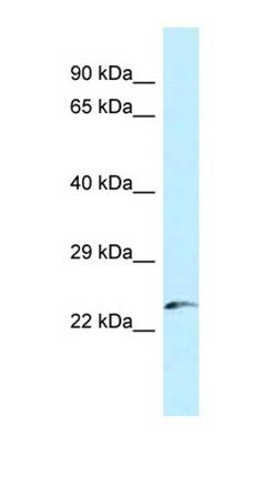 FLJ43806 antibody