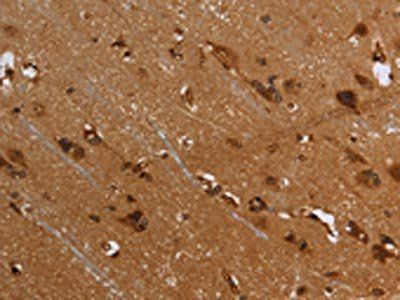 FLNA Antibody