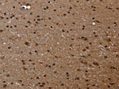 FLNA Antibody
