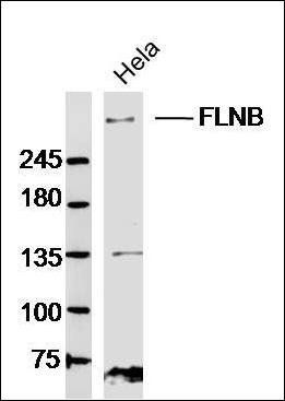FLNB antibody