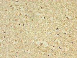 FLRT1 Antibody