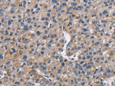 FLT3 Antibody