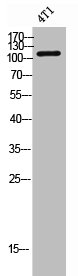 FLT3 antibody