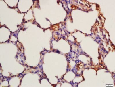 FLT3 (phospho-Tyr842) antibody