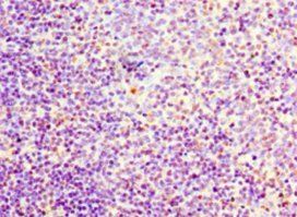 FLT3LG antibody