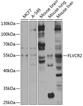 FLVCR2 antibody