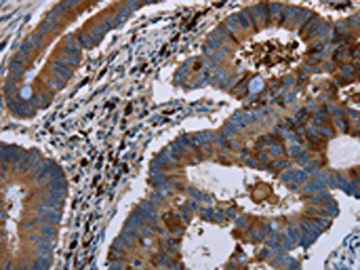 FMN2 Antibody