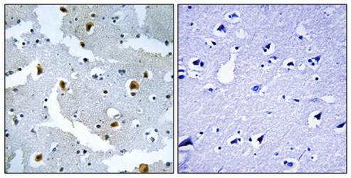 FMN2 Antibody