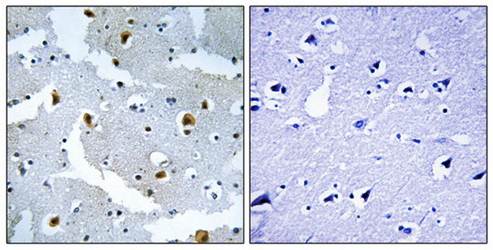 FMN2 antibody