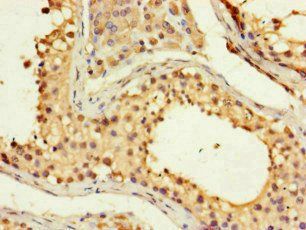 FMNL3 antibody