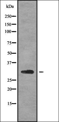 FMR1NB antibody