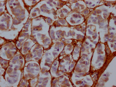 FN1 Recombinant Monoclonal Antibody