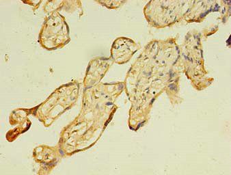 FNDC3B Antibody