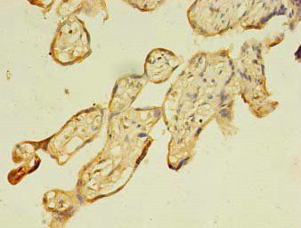 FNDC3B antibody