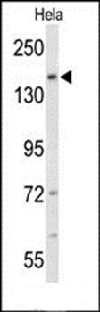 FNDC3B antibody