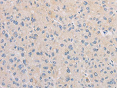 FNTA Antibody