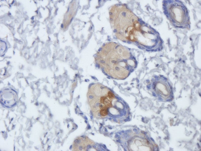 FOLR2 antibody