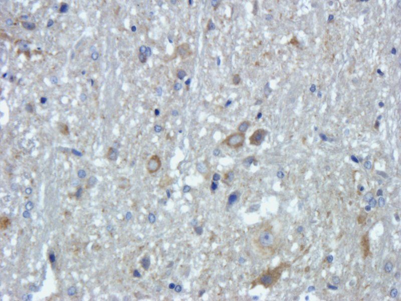 FOLR2 Rabbit Polyclonal Antibody