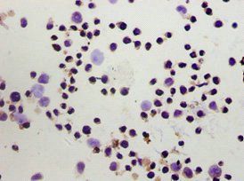 FOXP3 Antibody