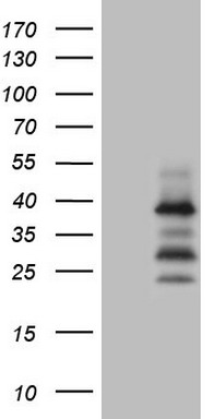 Fos B Antibody