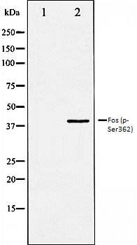 Fos (phospho-Ser362) antibody