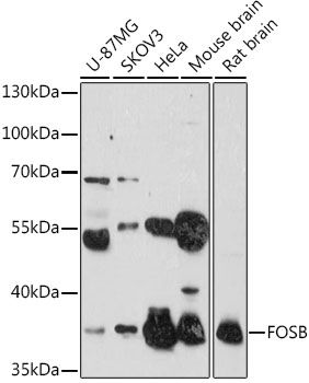 FOSB antibody
