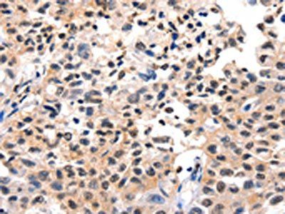 FOXB2 Antibody