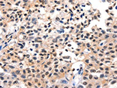 FOXB2 antibody