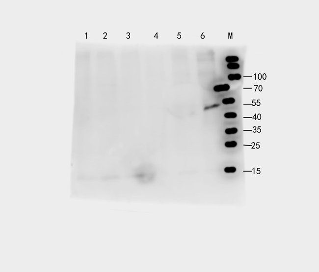 FOXC1 antibody