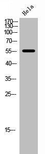 FOXC1 antibody