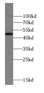 FOXD4L6 antibody
