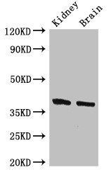 FOXE1 Antibody