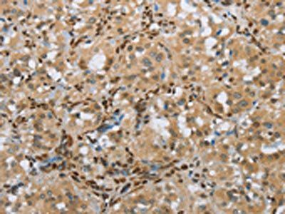 FOXE1 Antibody