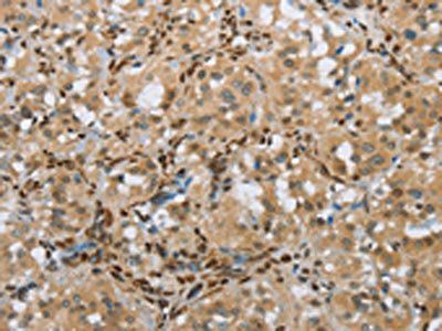 FOXE1 antibody