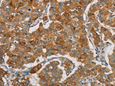 FOXF2 Antibody