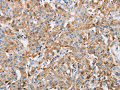 FOXF2 Antibody