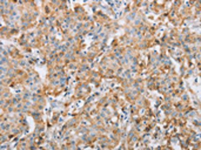 FOXF2 antibody