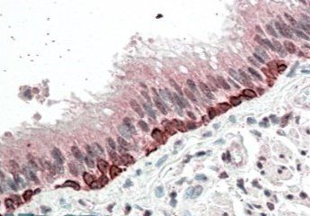 FOXI3 antibody