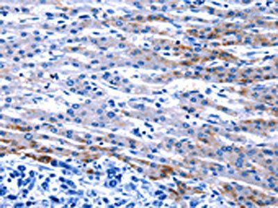 FOXJ1 antibody