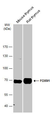 FOXN1 antibody
