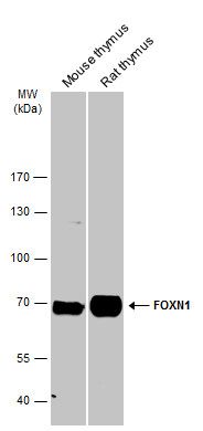FOXN1 Rabbit Polyclonal Antibody