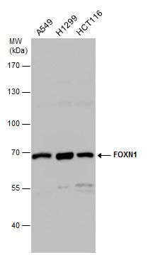 FOXN1 Rabbit Polyclonal Antibody